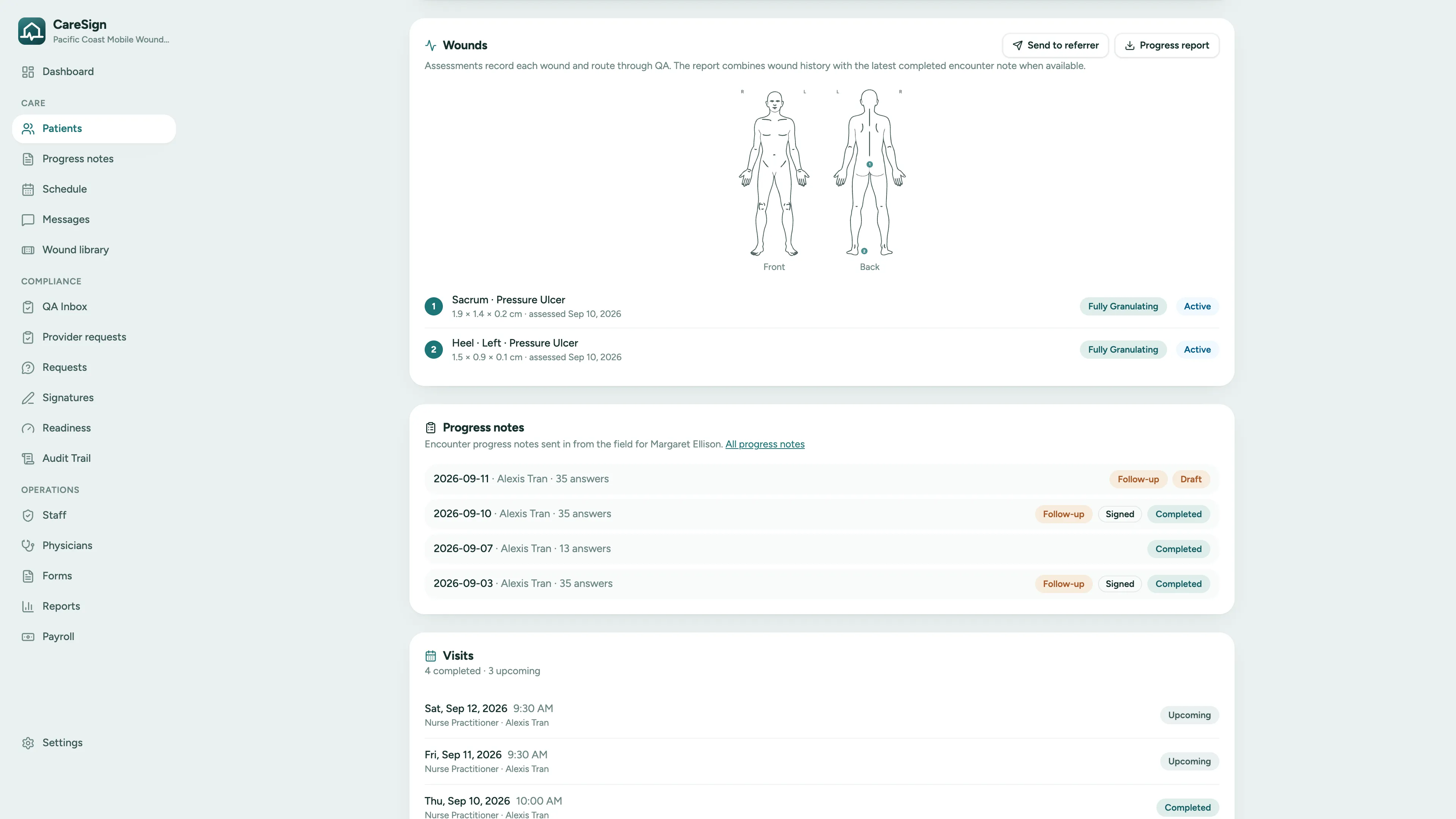 CareSign patient chart showing the anatomical body chart with two numbered wounds, each wound's latest measurements and healing status, and the list of progress notes from the field